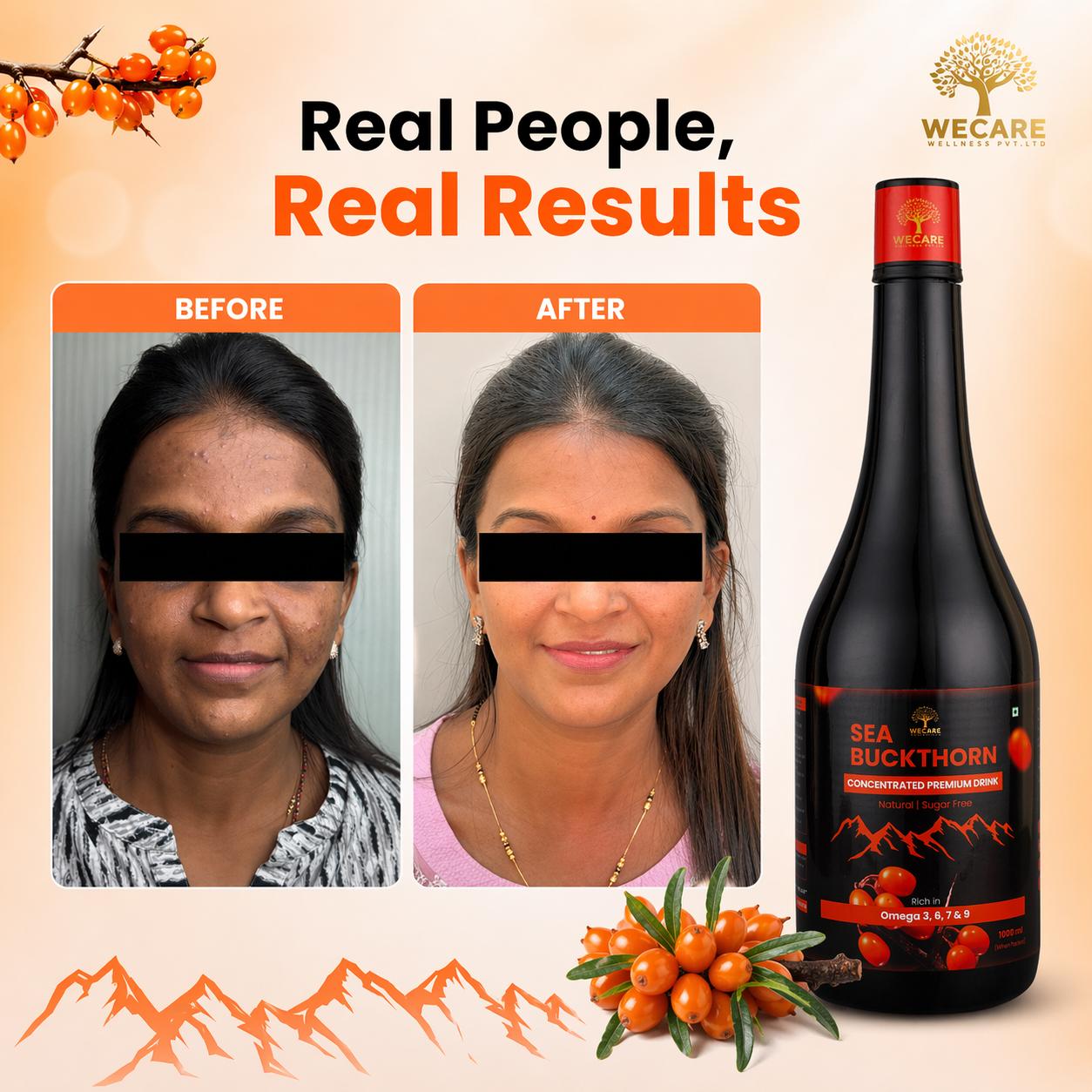 Sea Buckthorn Concentrated Premium Drink 1000ml | Rich in Omega 3 6 7 9 | Sugar Free Natural Health Drink | Immunity Booster | Skin & Hair Support